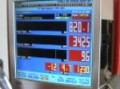 852 at 36 psi of boost